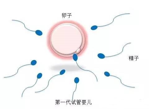 供卵代怀包生男孩机构